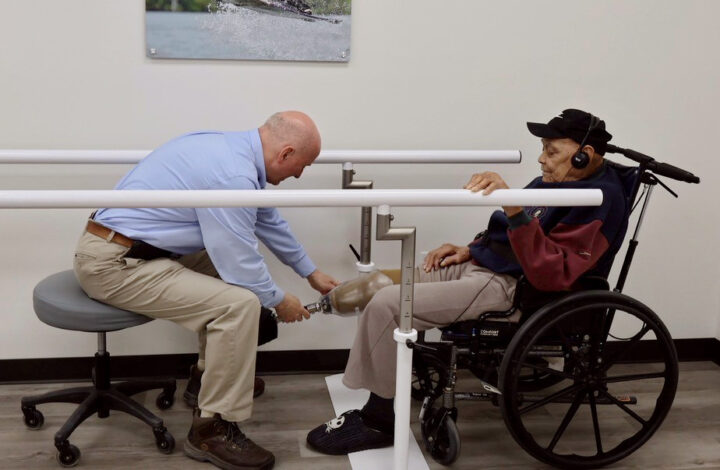 Fitting for a custom leg prosthetic