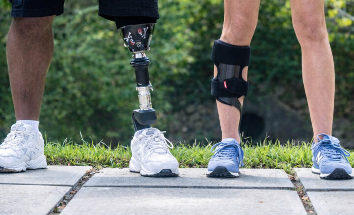 Custom leg orthotics and prosthetic